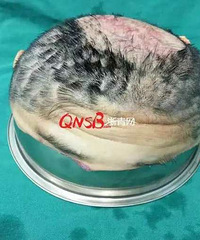 �����㣩���£��㽭һŮ��ͷ������ͷƤһ�𱻻���˺������