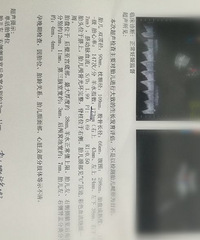 ���������ǣ���ȥʡ���������˴Ź������