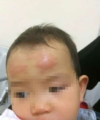 18�´�ŮӤʹ����������ͷ���� ����2������