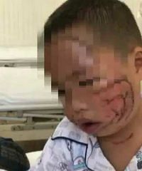 3����ͯ���ʿ��˺ҧ ������˺�÷��200����