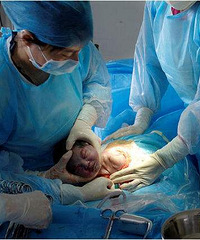 "老婆生孩子到一半,突然噗嗤一声响,老公一"