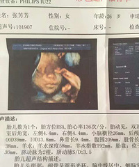 【2017生产日记】医生给老公下了病危通知书,然后。。。