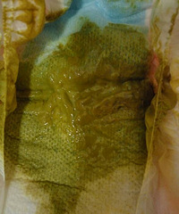 ��ҽ����ã�4�����µ�С������������ִ�