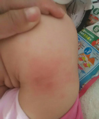 ��������ǲ���ʪ�