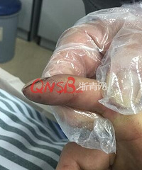 杭州一小伙掰开了它的嘴...结果抢救了整整4天!