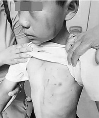 "13岁男孩被打:铁架或板凳 母亲抡起什么"