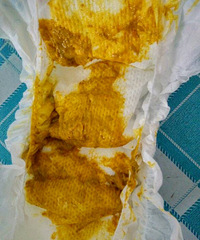 ��ҽ����ã�����¼����С�����Ը�ƻ����