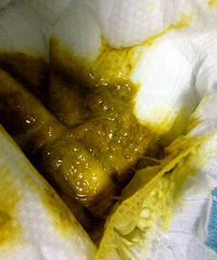 ��ҽ����ã�5����3���С�����������ִ�