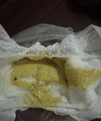 ��ҽ����ã�13���µ�С�����������ִ��