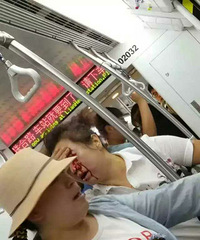 "女子称\"你肚里孩子早晚得掉\"激怒孕妇 脸被砸流血"