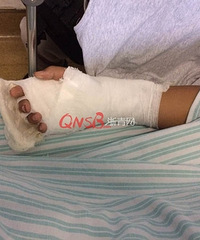"杭州12岁男孩尿急一头撞碎卫生间玻璃移门 右手中指掌侧被割开"