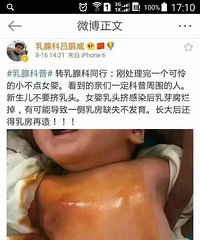 #新生儿分泌乳汁是怎么回事?#