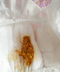 ��ҽ��������������������һ���ģ�Ҫ��Ҫ����