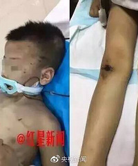 6����ͯ�������Ű�� �Դ����ر���