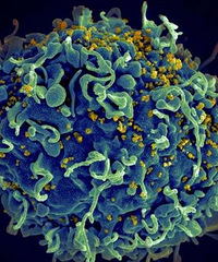 "研究揭示 HIV 成功逃过抗病毒治疗,持久性存在的主要原因!"