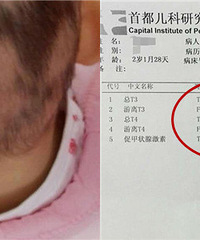 妈妈,我掉光的头发什么时候能长出来?