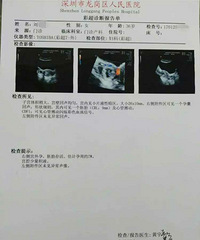 "36岁女子宫外孕被误诊为先兆性流产 并开了保胎药"