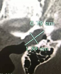 5�꺢���ͿŶ�ʺ����5000��Ǯ��������ȫ��������