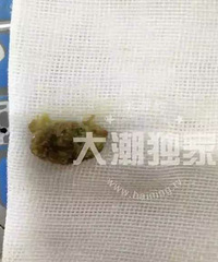 �������걦�����ӷ��� ҽ����ȡ����һ����÷��