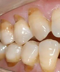 ��ͣ�£�������ݿ챻ˢ����