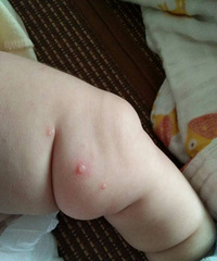 ����2����23�����ϳ����������� Ϳ��ҩ�о�Ҳû��ȥ��ô��