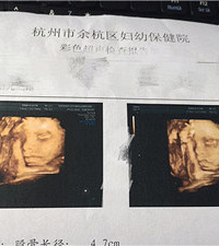 "恋爱6年终于结婚,经历生化妊娠、唐筛高危…宝宝出生却意想不到