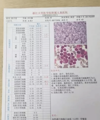 白血病_早期症状_早期症状_育儿知识_19楼亲子