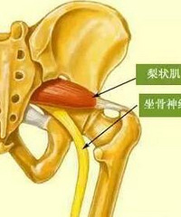 "久坐腰不疼,腿麻屁股疼?"