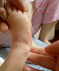 ������ĸ��������ʪ�� ҽ�����ҳ������죡