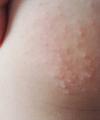 �鷳��������ƨƨ�ϵ���Щ��ʲô����