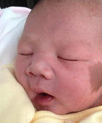 "婴儿为什么会长胎记?现在知道还不算晚"