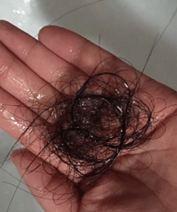 生完小孩后一直掉头发 最近头发掉的特别厉害 是什么原因呢