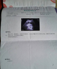 ��������ˮ�ݱ��������ռǡ��ڴ�����Ǹ�����С�ް�