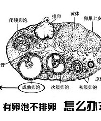 "不排卵是什么原因 备孕过程中的你出现这些就要尽早就医"