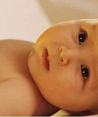"母乳性黄疸怎么办 应该如何治疗?"