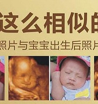 "四维彩超有必要做吗 四维超声你了解吗"