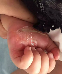 "杭州到底有多热?19个月女童摔倒在铁皮上"