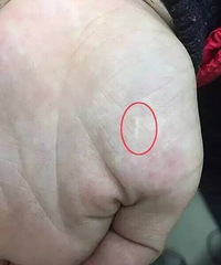 "萧山5岁男孩不爱吃饭,妈妈竟然带他去……"