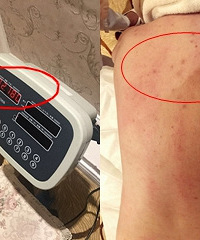 按摩完身上星星点点,但效果肥肠厉害!