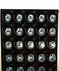 С����������Ѫ ��������������ʴ�  ҽ�����龡������..