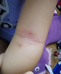 2����Ů���� 2�����϶���Ѣ