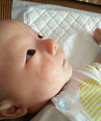 ������ӲӲ�Ķ��� ��ҪȥҽԺ����