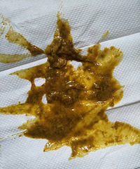 ��ҽ������λ������ҿ�����������ô��