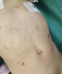 3��Ůͯ�����Ű����­�ڳ�Ѫ����������