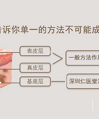 深圳仁医堂皮肤医学研究院:怎么实现少女无斑梦