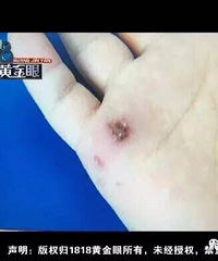 ��ͯ��԰�棬�к�ͻȻ���磺"�����˶����£����϶���Ѫ��