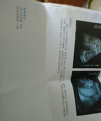 37��b���̺ۺ��Լ2mm 35�����̥ ʲôʱ���ʺ��ʣ�