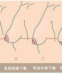 "产后乳房下垂怎么保养 如何向乳房下垂轻松说再见"