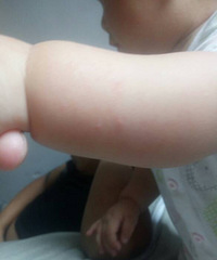 ��ҽ����ã���Ů������סԺ����Ժ���졣��