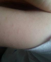 ������������סԺ �ճ�Ժ��������������������